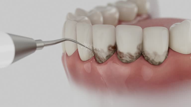 Trusted Dental Crowns And Bridges service in Robinson, TX - Dentist Open Now